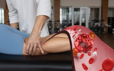 Beneficios y consideraciones de las fístulas arteriovenosas para diálisis